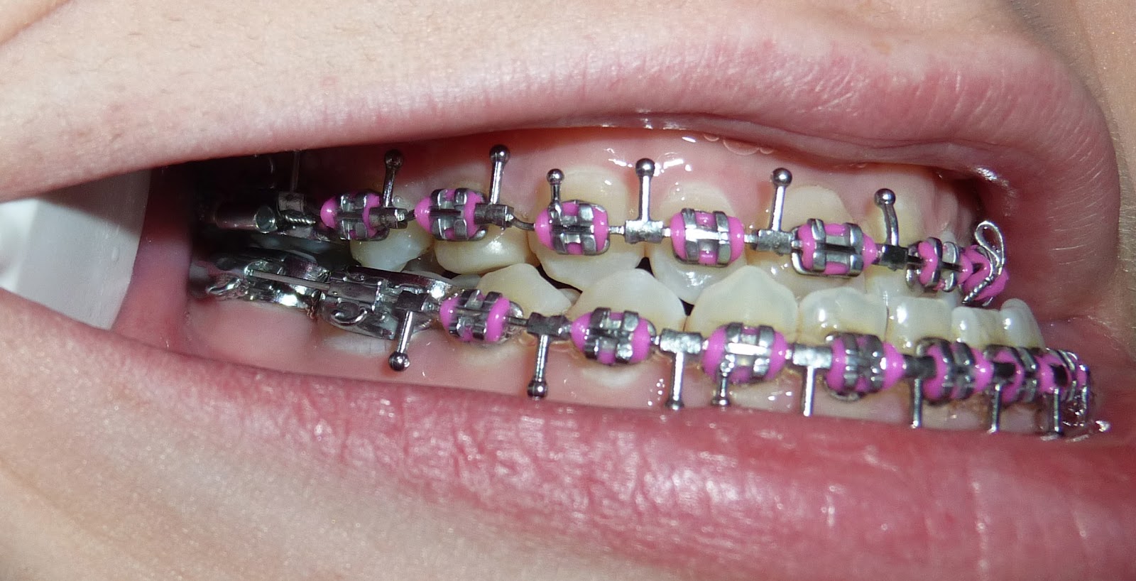 14 ramas de la odontología