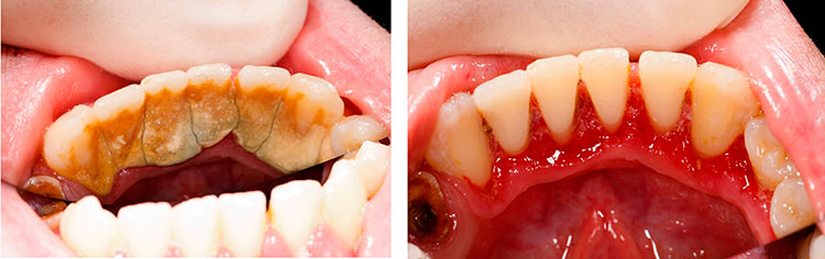 importancia de la periodontología 