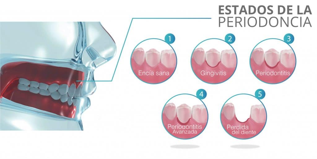 periodoncia vs ortodoncia