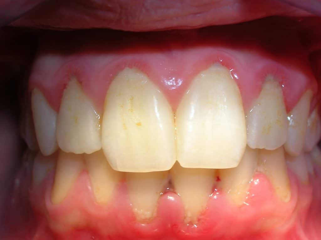 periodoncista